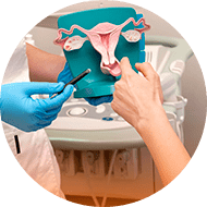 Cirurgia para Endometriose