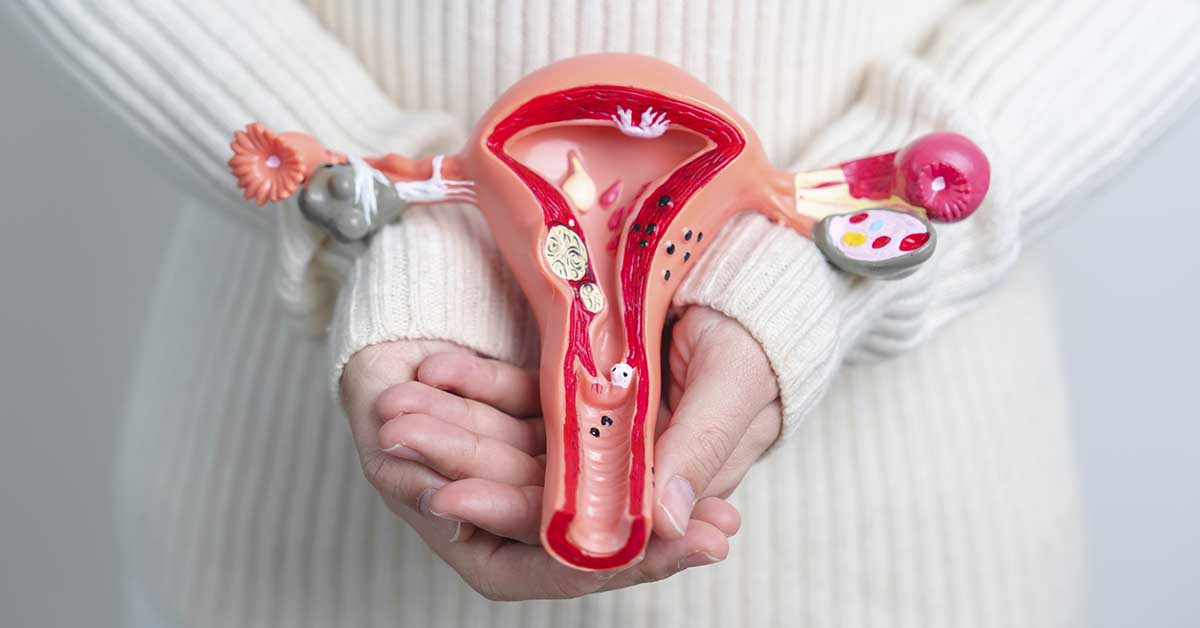 Sintomas de endometriose: a dor não é "normal" 2 Sintomas de endometriose: a dor não é "normal"