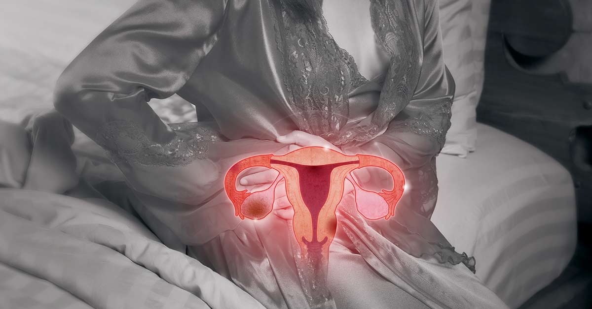 Tratamento-de-Mioma_-Comparativo-entre-Opcoes-Medicamentosas-e-Cirurgicas