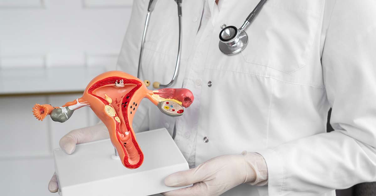 Tratamento-de-Mioma_-Comparativo-entre-Opcoes-Medicamentosas-e-Cirurgicas