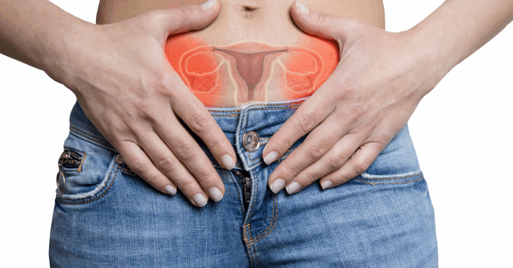 Endometrioma no Ovário Esquerdo: sintomas e impactos