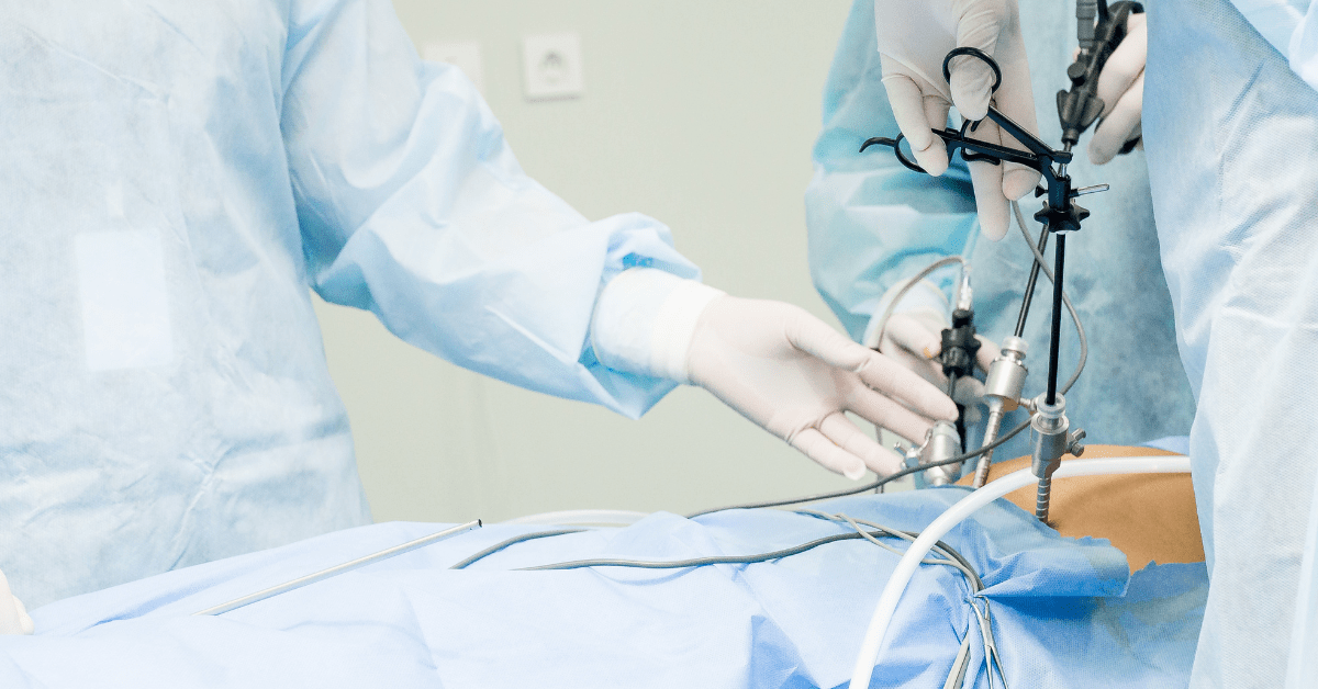 Tratando Endometrioma Ovariano: estratégias eficazes e novas abordagens 3 Tratando Endometrioma Ovariano estratégias eficazes e novas abordagens