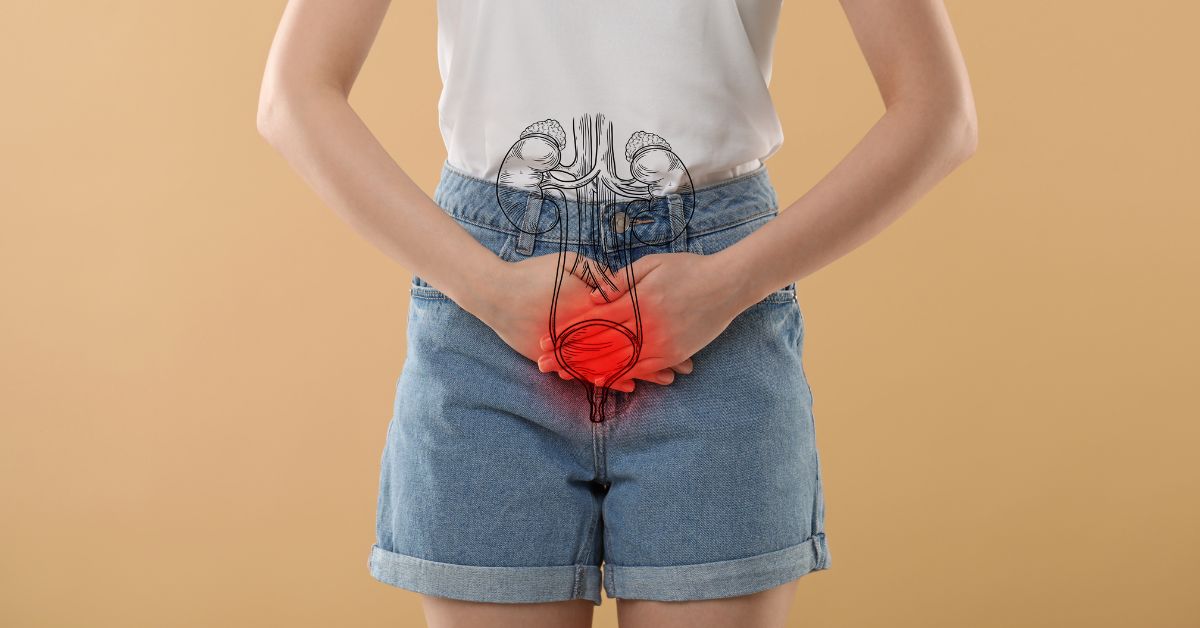 Videolaparoscopia para endometriose: entenda o procedimento minimamente invasivo 1 Videolaparoscopia para endometriose: entenda o procedimento minimamente invasivo